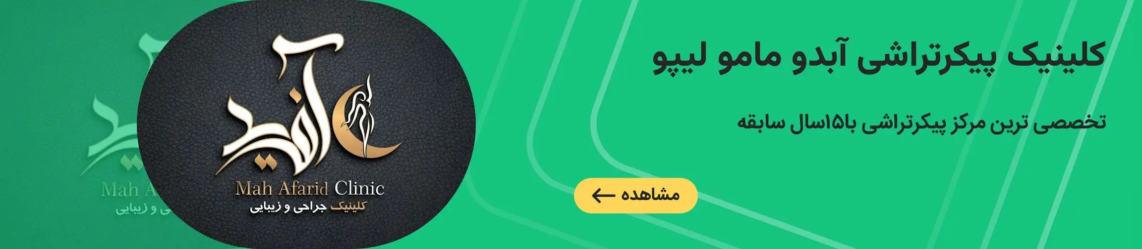 بنر تبلیغاتی