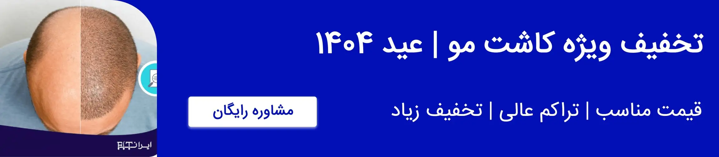 بنر تبلیغاتی