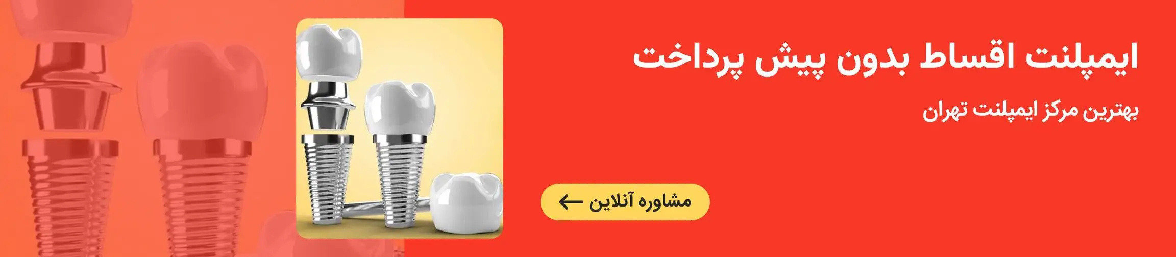 بنر تبلیغاتی