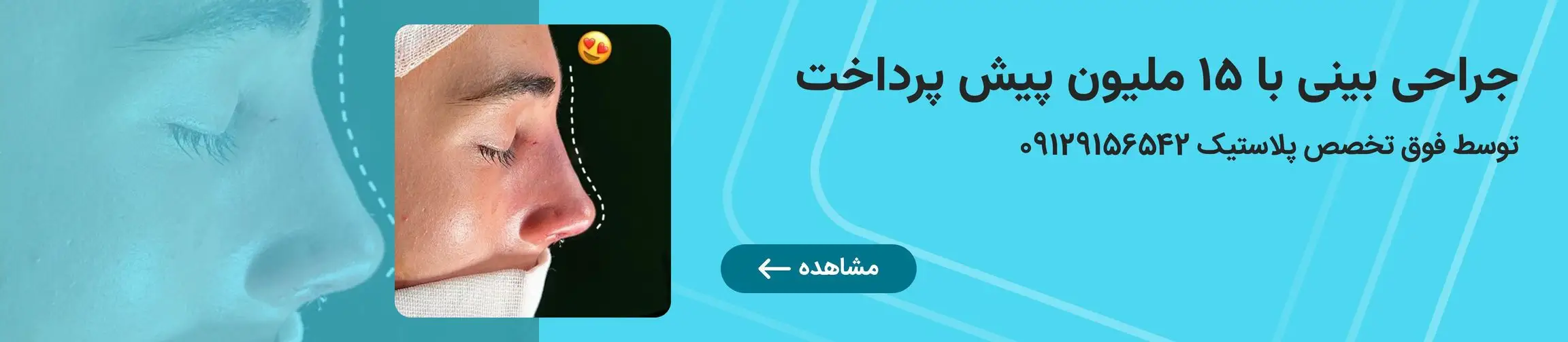 بنر تبلیغاتی