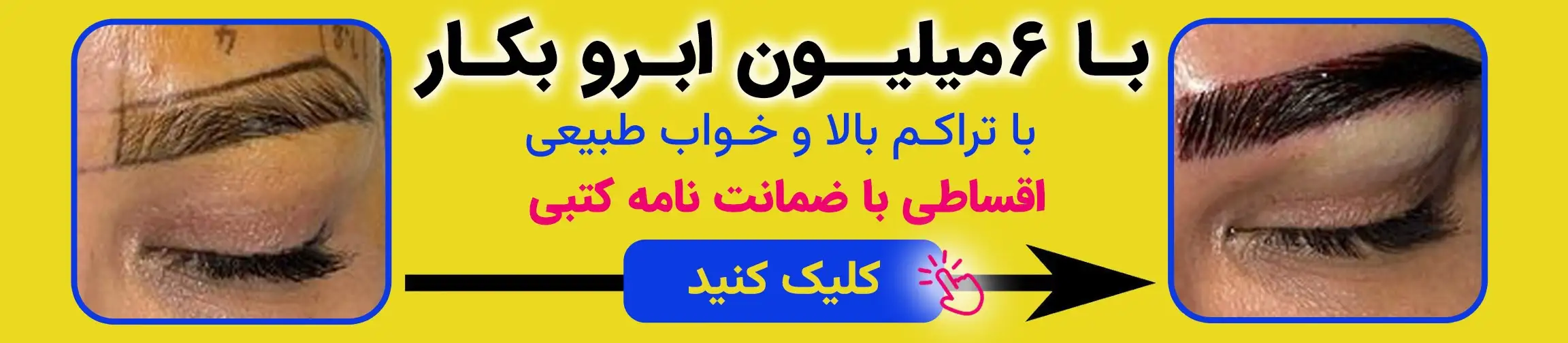 بنر تبلیغاتی