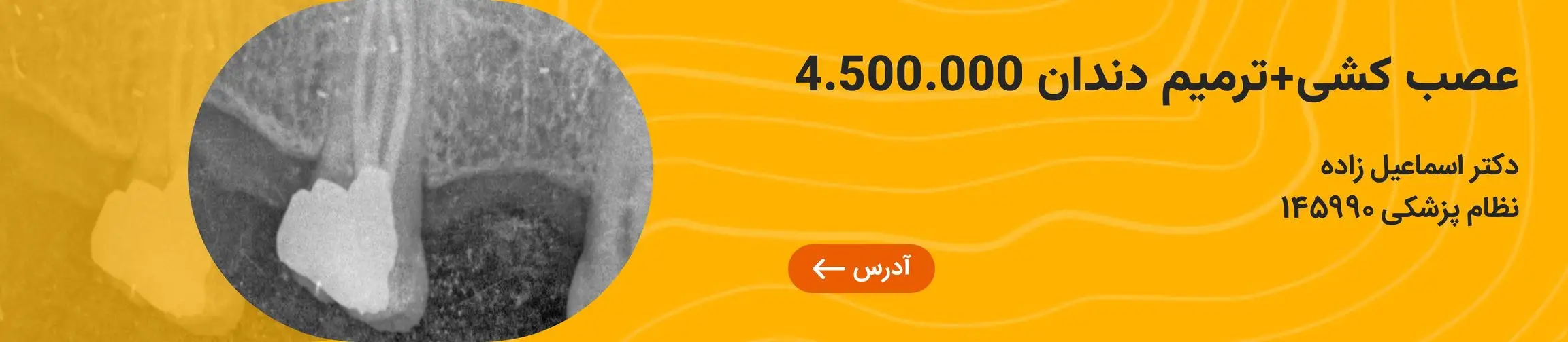 بنر تبلیغاتی