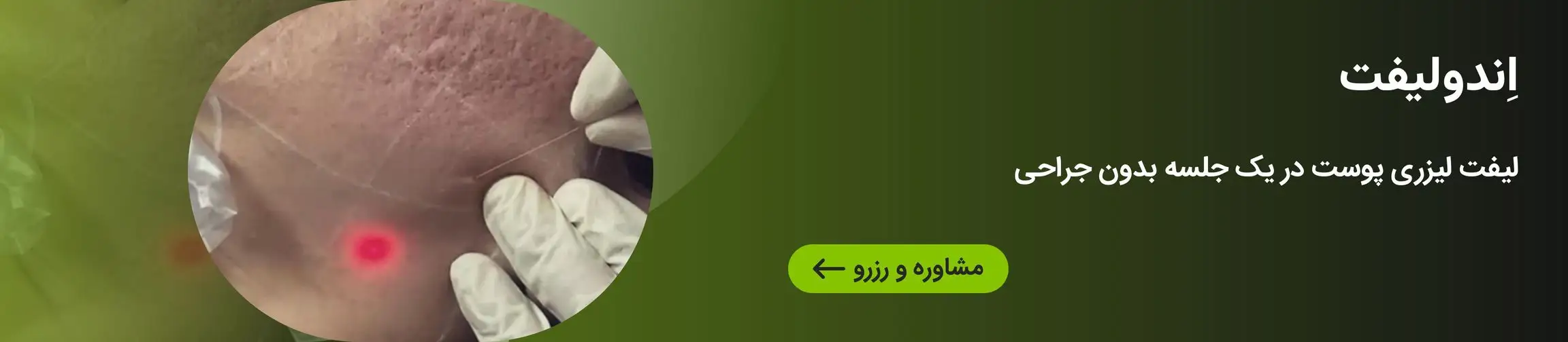 بنر تبلیغاتی