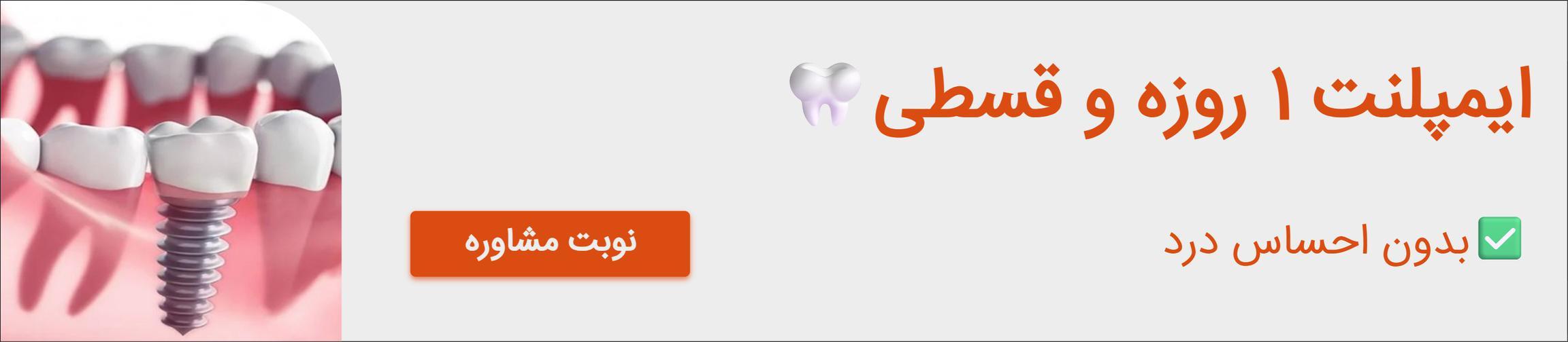 بنر تبلیغاتی