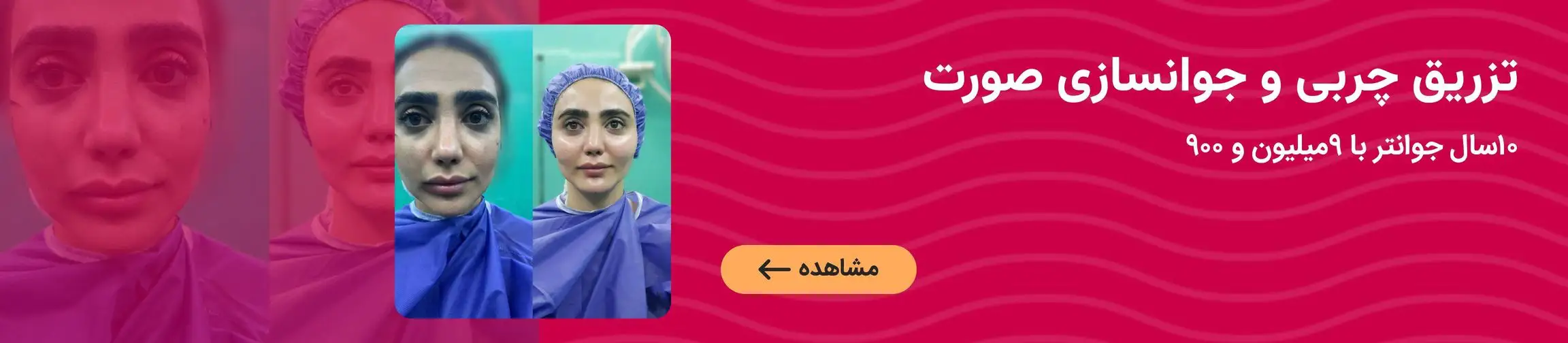 بنر تبلیغاتی