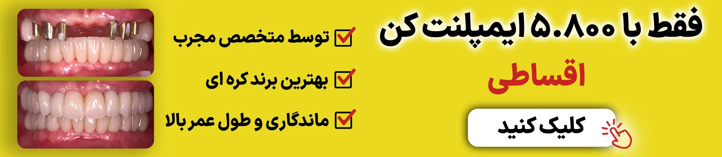 بنر تبلیغاتی