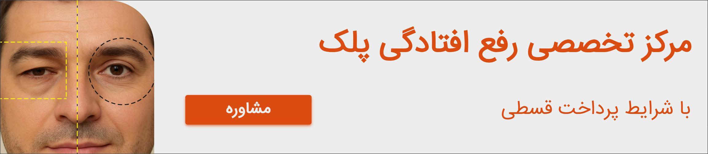 بنر تبلیغاتی