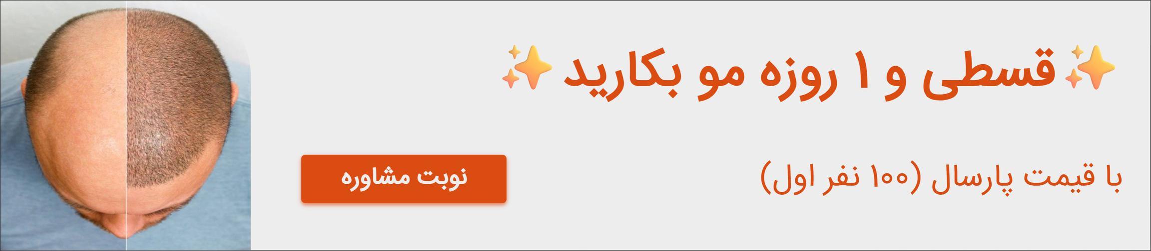 بنر تبلیغاتی