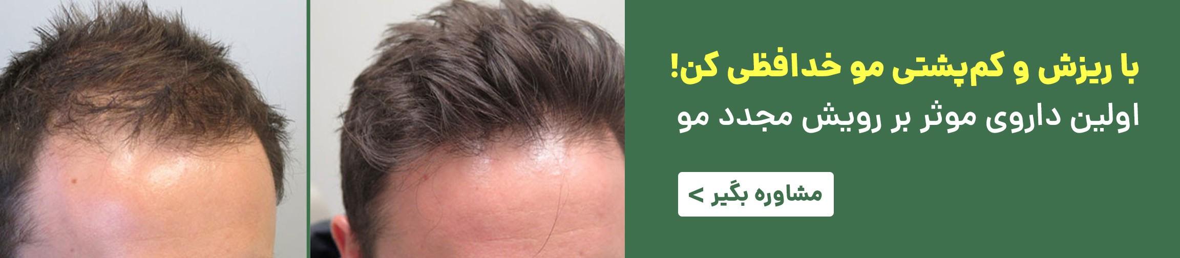 بنر تبلیغاتی