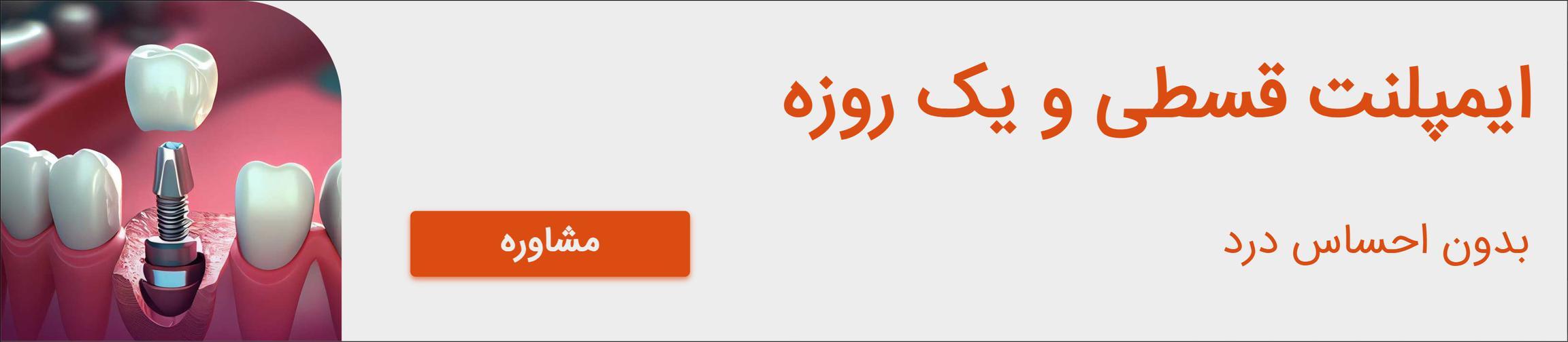 بنر تبلیغاتی