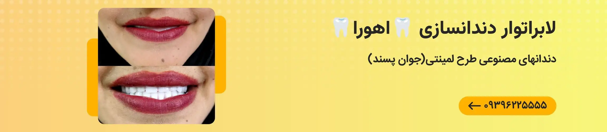 بنر تبلیغاتی