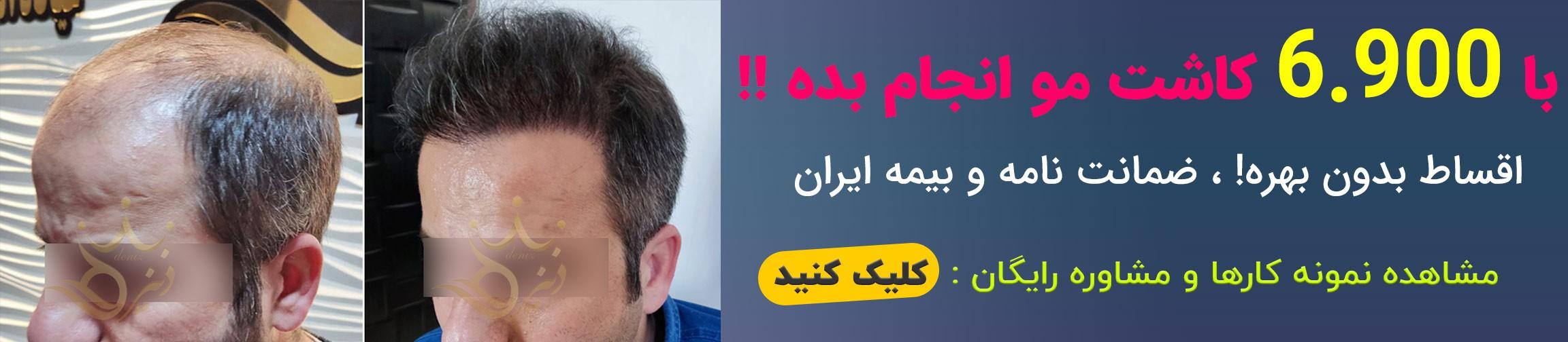 بنر تبلیغاتی