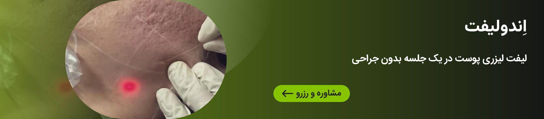 بنر تبلیغاتی