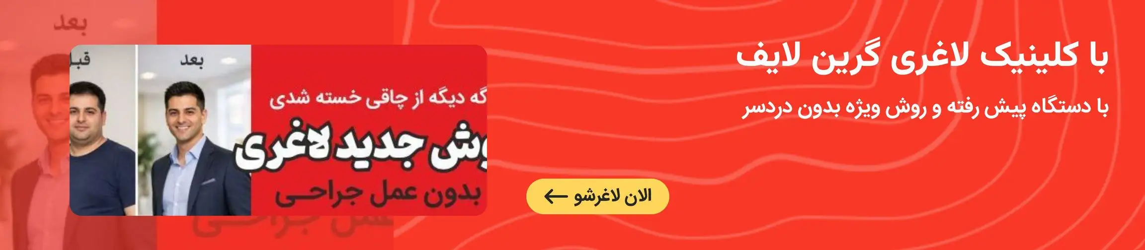 بنر تبلیغاتی