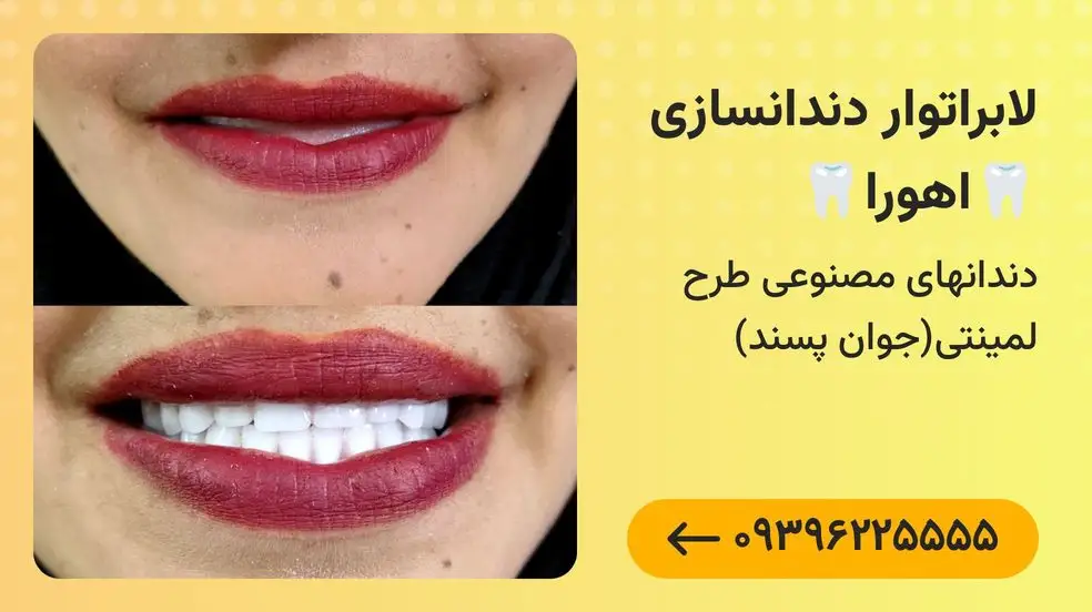 بنر تبلیغاتی