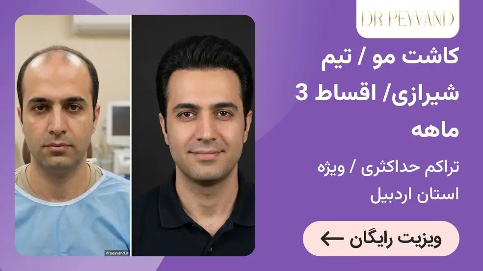 بنر تبلیغاتی