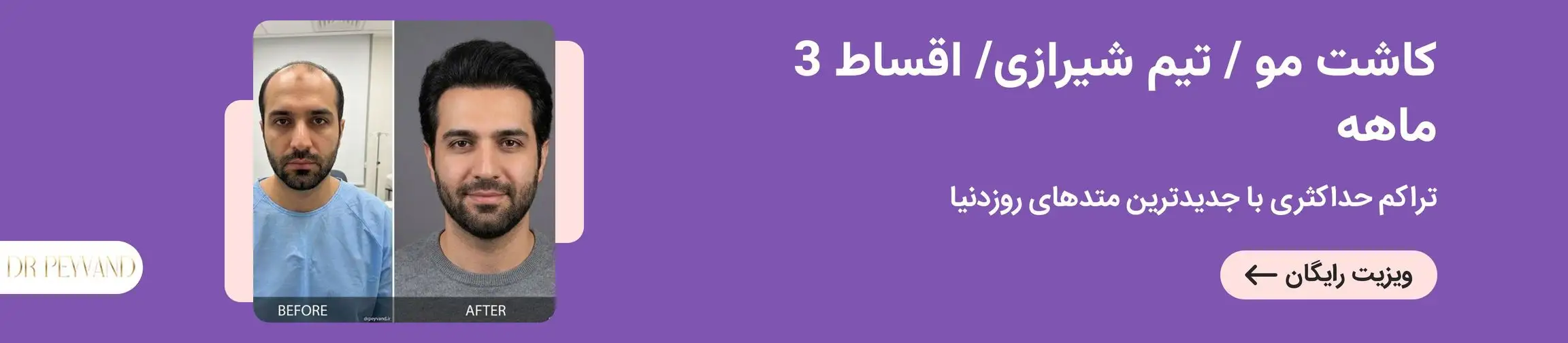 بنر تبلیغاتی