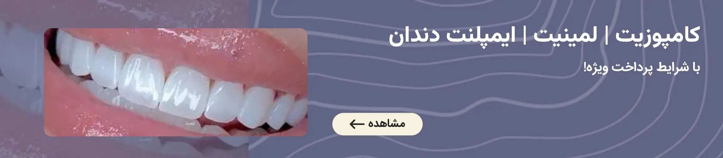 بنر تبلیغاتی