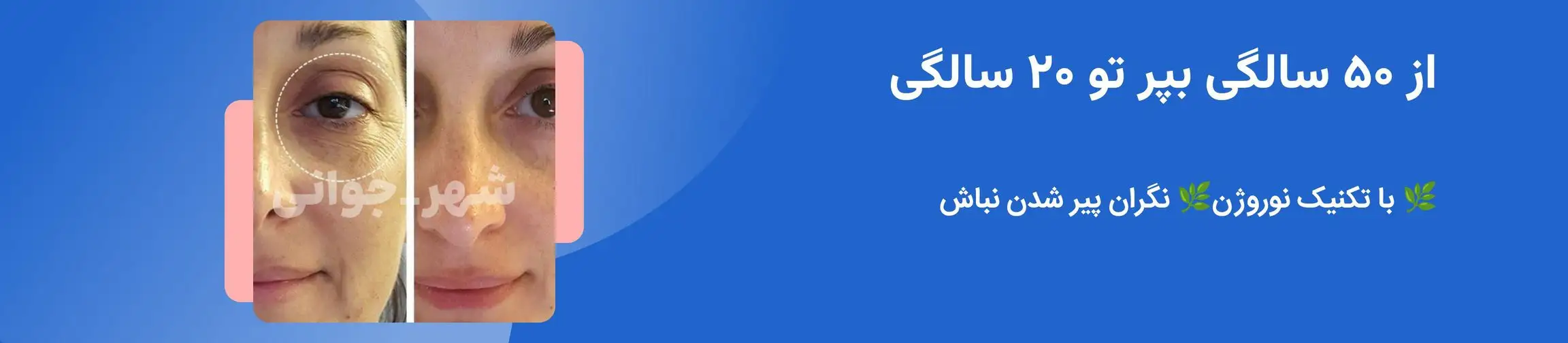 بنر تبلیغاتی