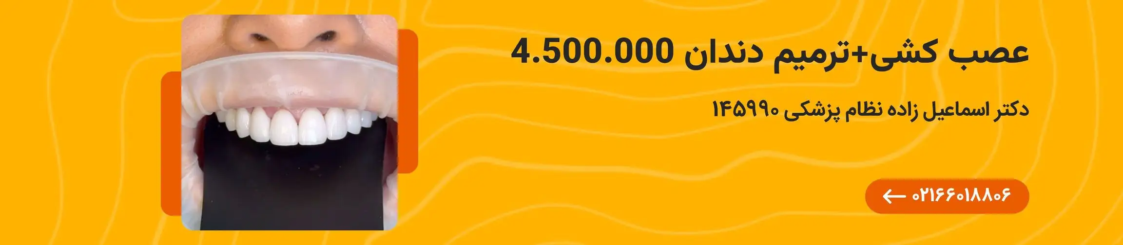 بنر تبلیغاتی