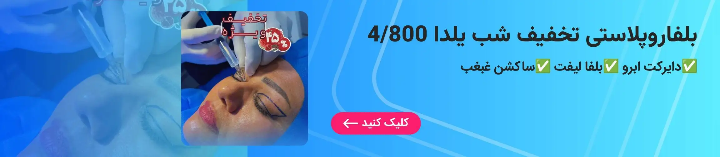 بنر تبلیغاتی