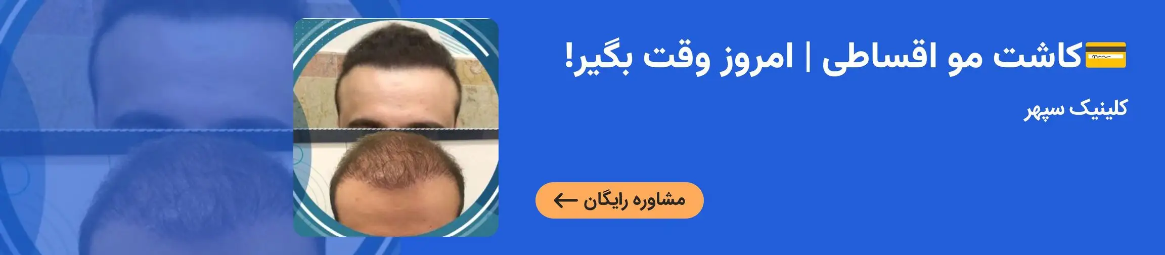 بنر تبلیغاتی