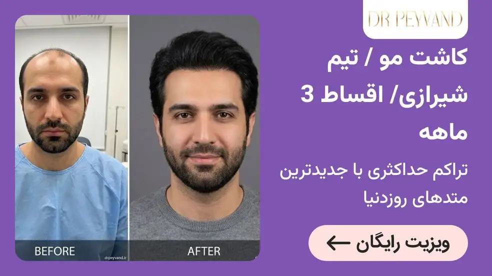 بنر تبلیغاتی