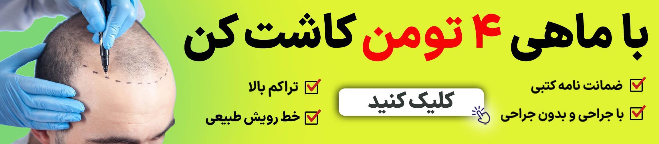 بنر تبلیغاتی