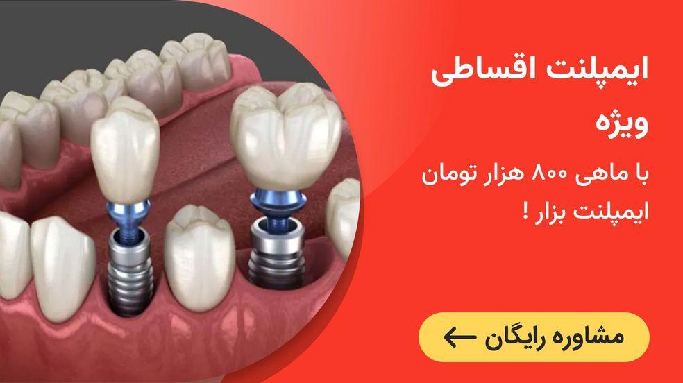 بنر تبلیغاتی