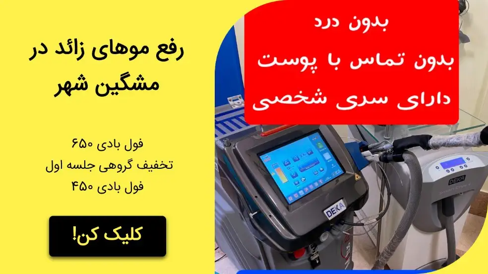 بنر تبلیغاتی