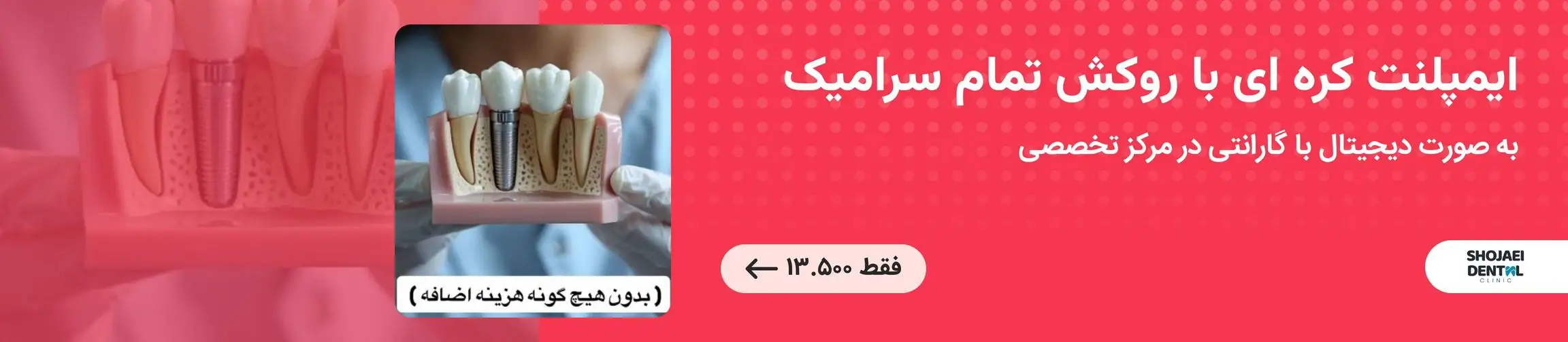 بنر تبلیغاتی