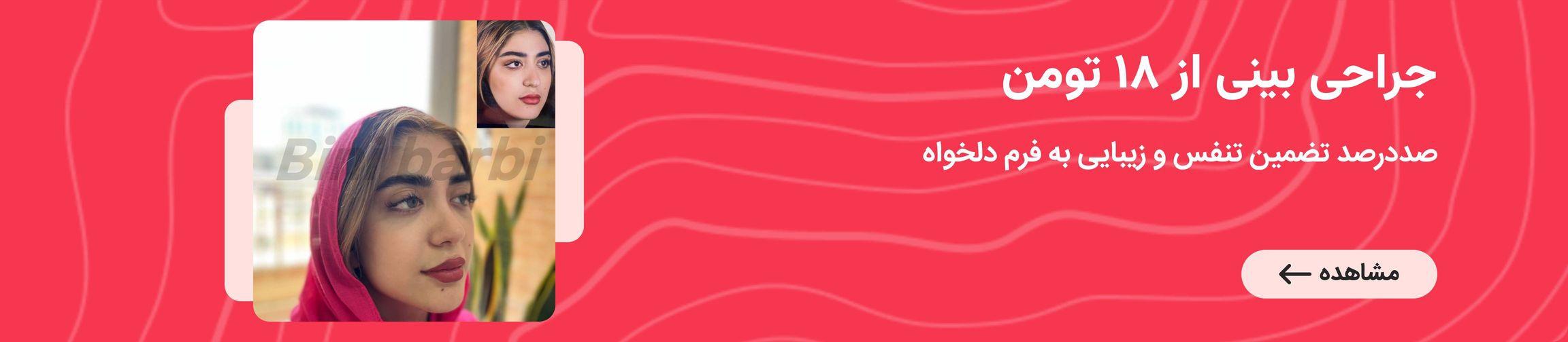 بنر تبلیغاتی