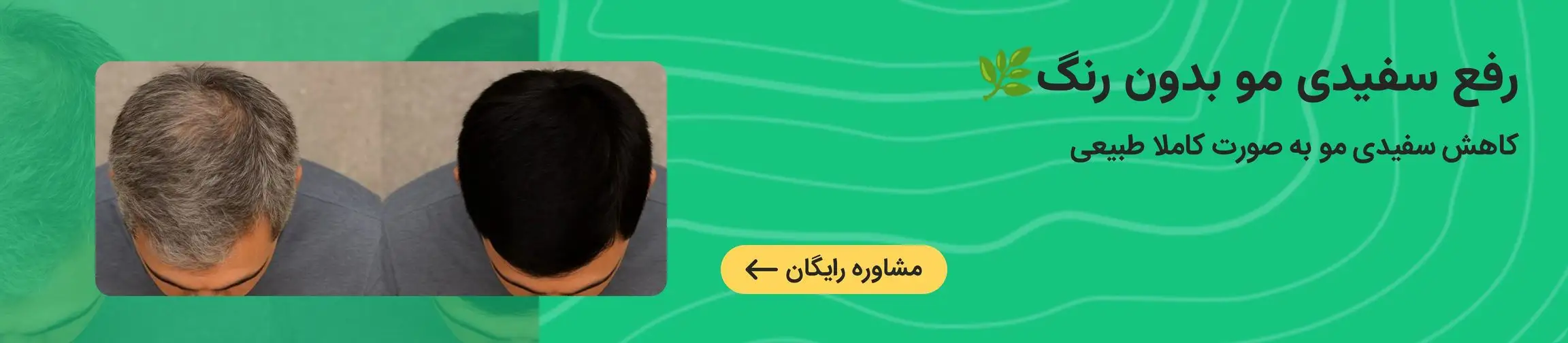 بنر تبلیغاتی