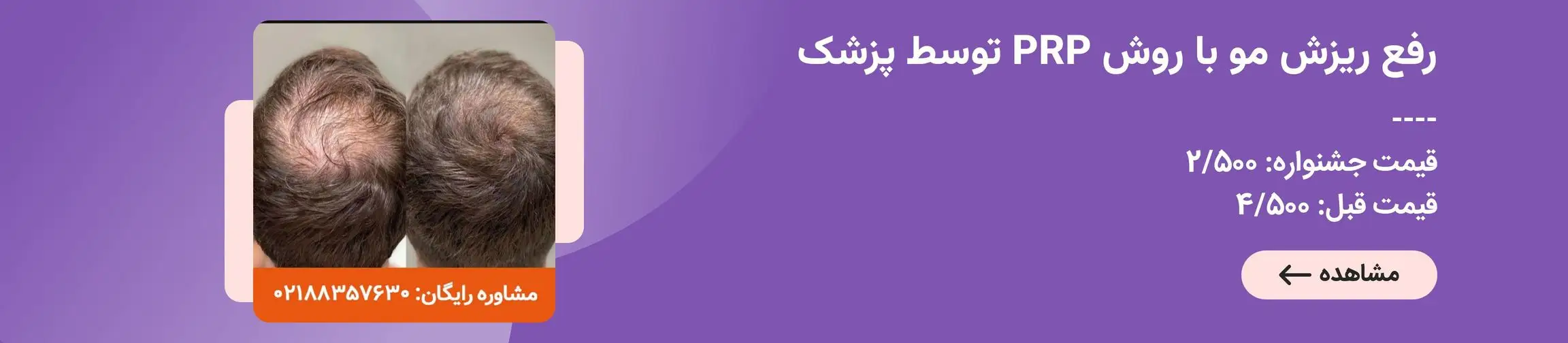 بنر تبلیغاتی