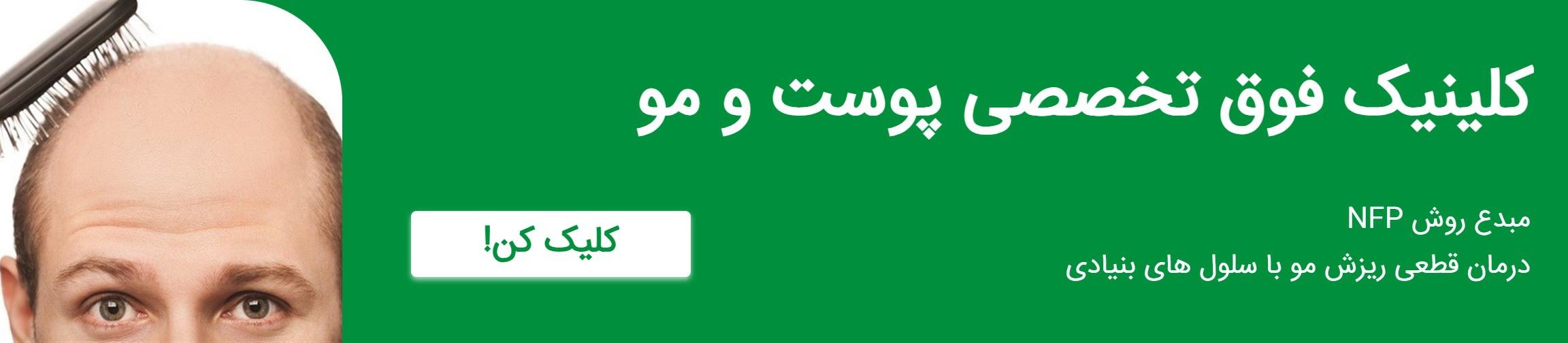 بنر تبلیغاتی