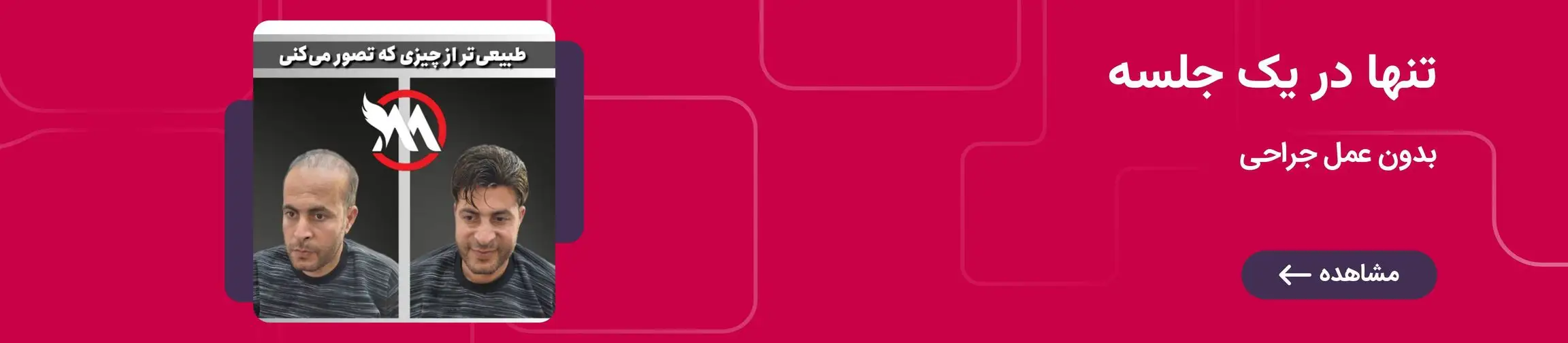 بنر تبلیغاتی