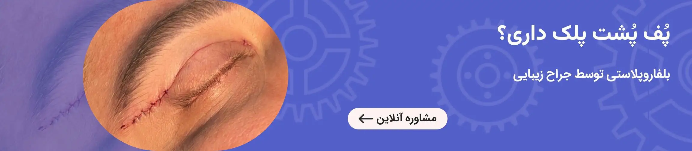 بنر تبلیغاتی