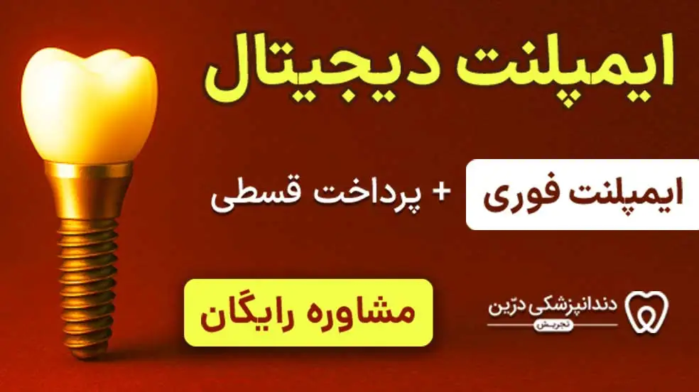 بنر تبلیغاتی