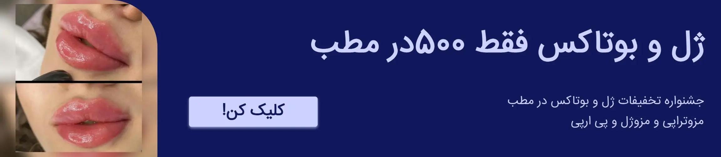 بنر تبلیغاتی