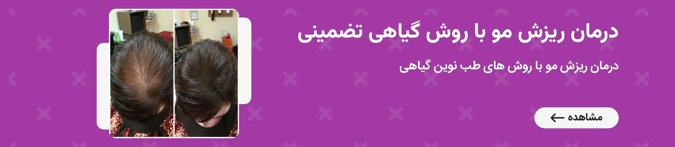 بنر تبلیغاتی