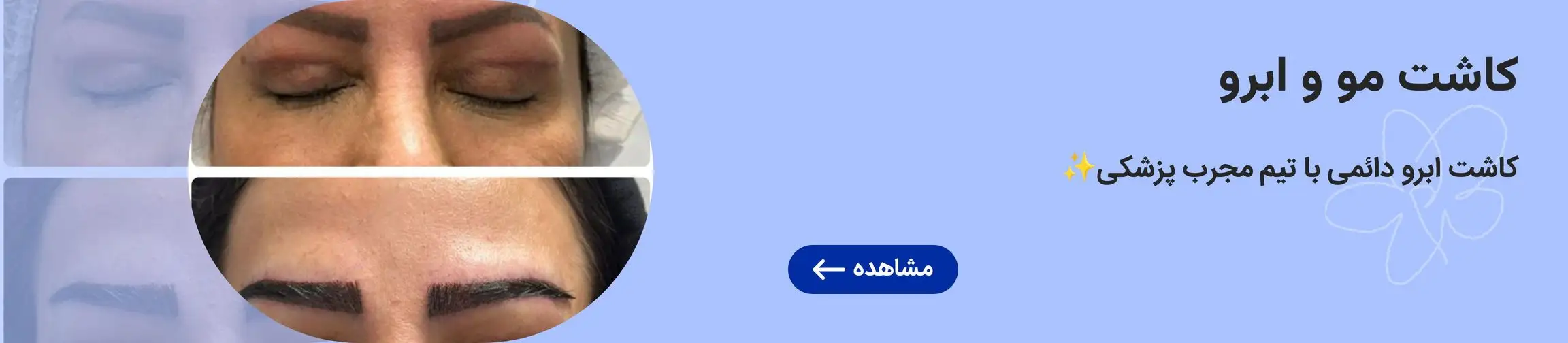 بنر تبلیغاتی