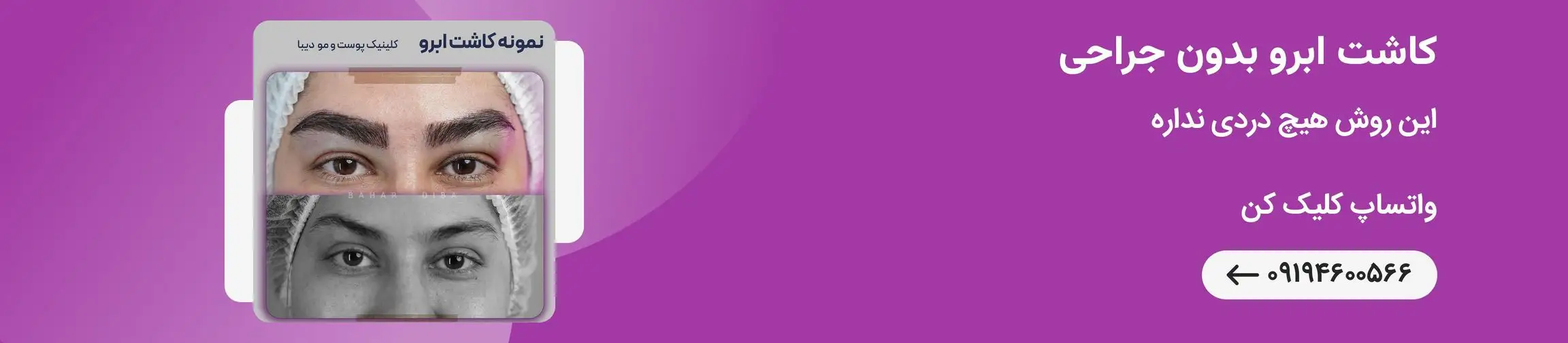 بنر تبلیغاتی