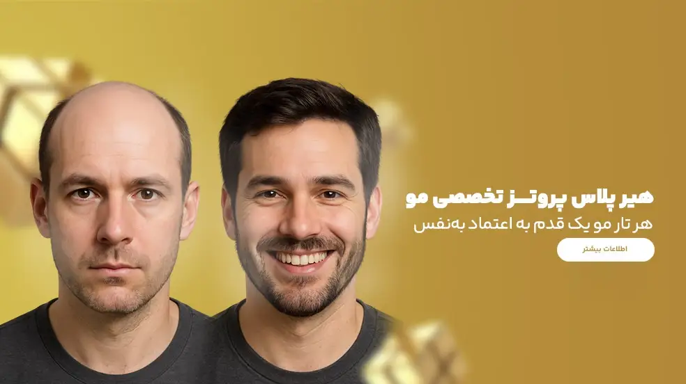 بنر تبلیغاتی