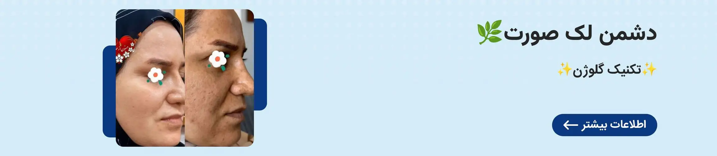 بنر تبلیغاتی