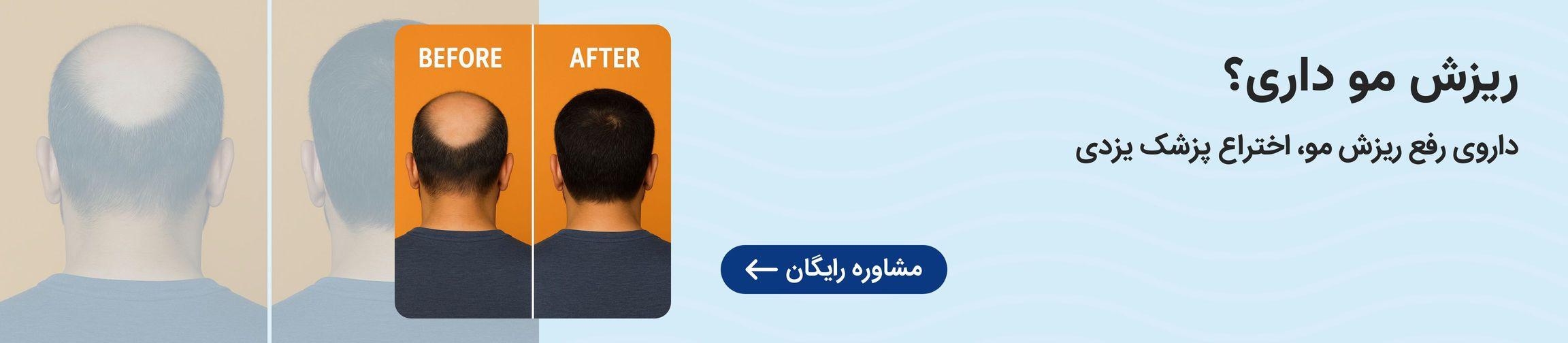 بنر تبلیغاتی