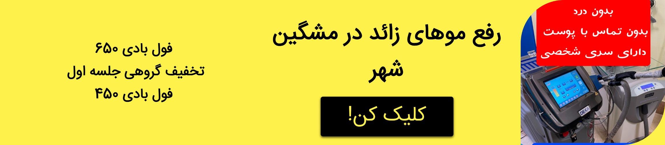 بنر تبلیغاتی