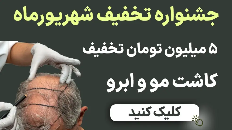 بنر تبلیغاتی