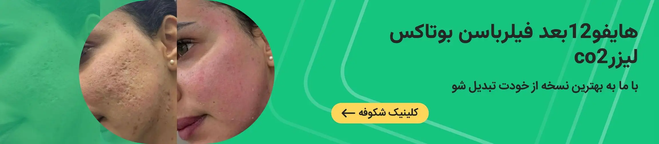 بنر تبلیغاتی