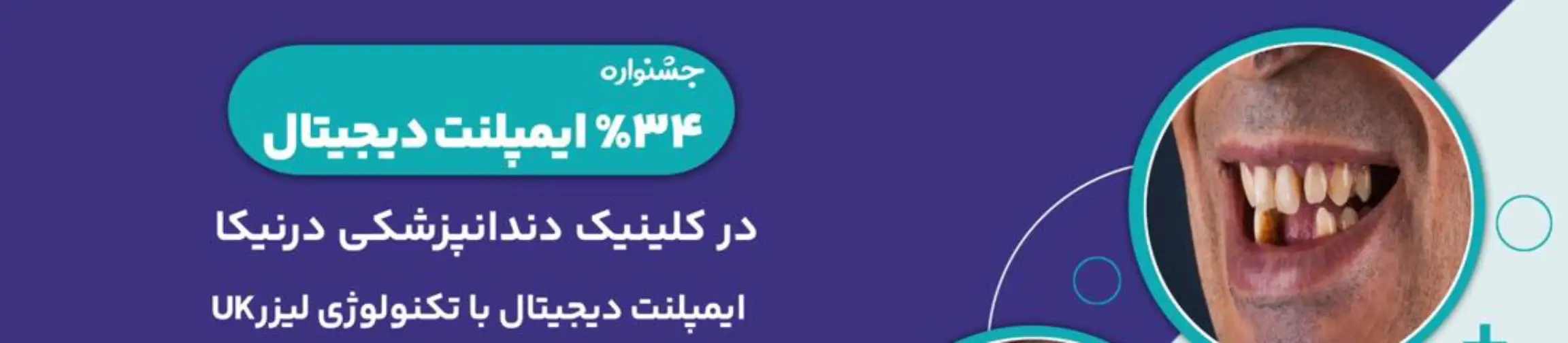 بنر تبلیغاتی