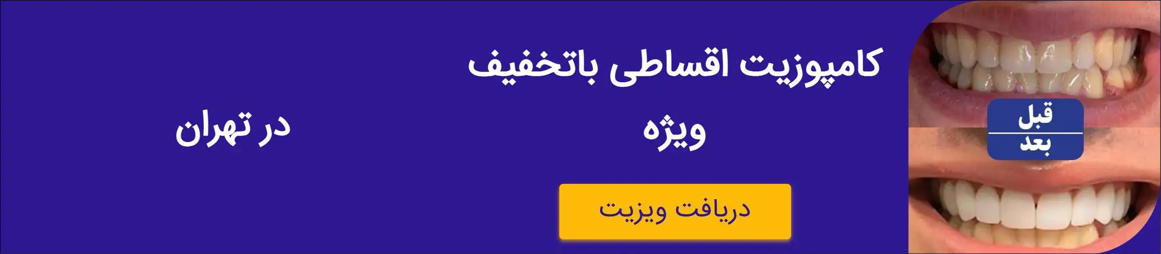 بنر تبلیغاتی